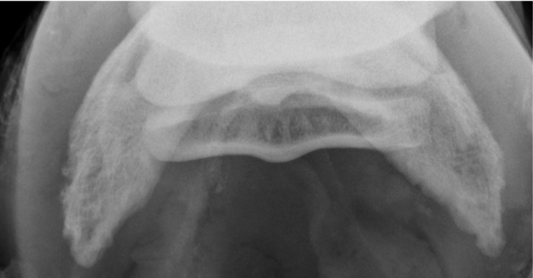 How to Treat Navicular Disease?